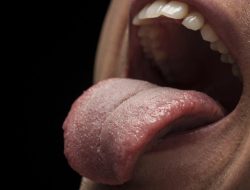 Tanda Kena Kanker atau Diabetes Bisa Dilihat dari Warna Lidah