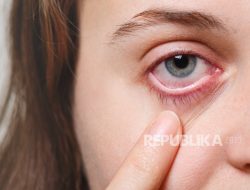 Kedutan Wajah Berulang Bisa Jadi Bukan Sekadar Tanda Kelelahan